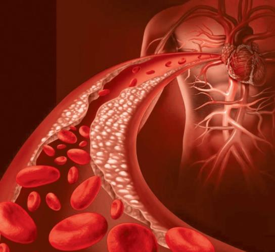 每天壓腿能減輕腳疼 特別是穿高跟鞋的女性！